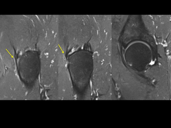 Figure 4 for case joint capsule ( RID6072 )